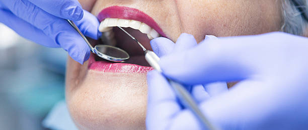 Best Dentist for Tooth Abscess  in Brandenburg, KY